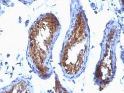 MVP Antibody (SPM280), Novus Biologicals 0.2mg; Unlabeled:Antibodies, Monoclonal